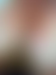 Tumori della laringe: quando un sintomo deve preoccupare?