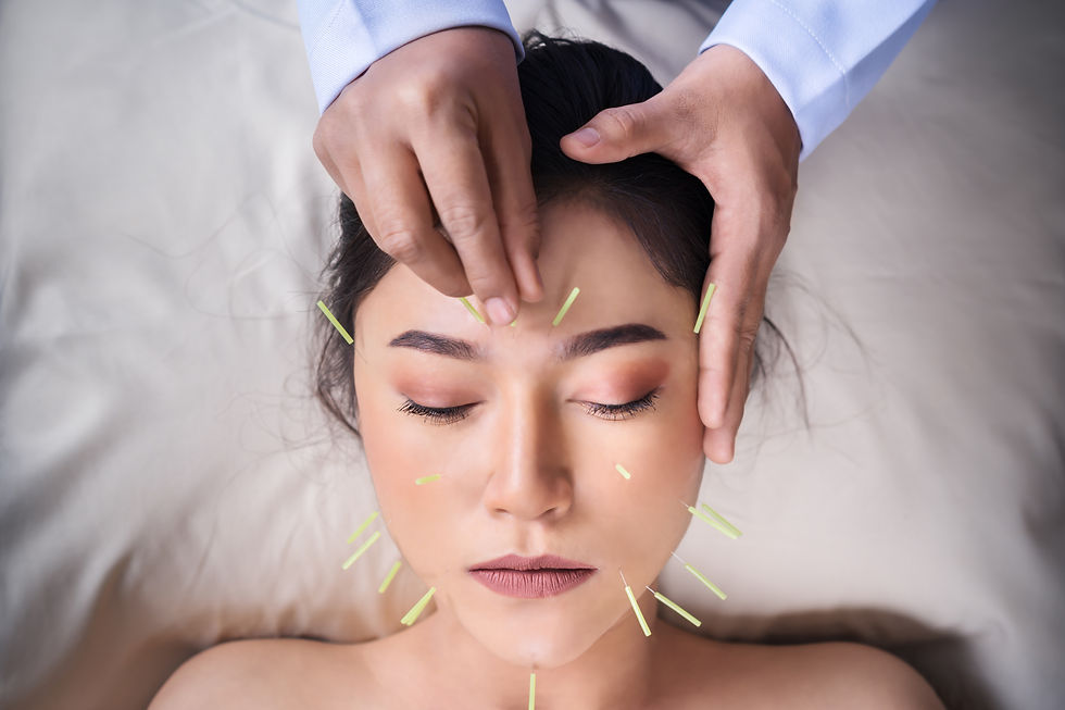 young woman undergoing acupuncture treatment on face_edited.jpg
