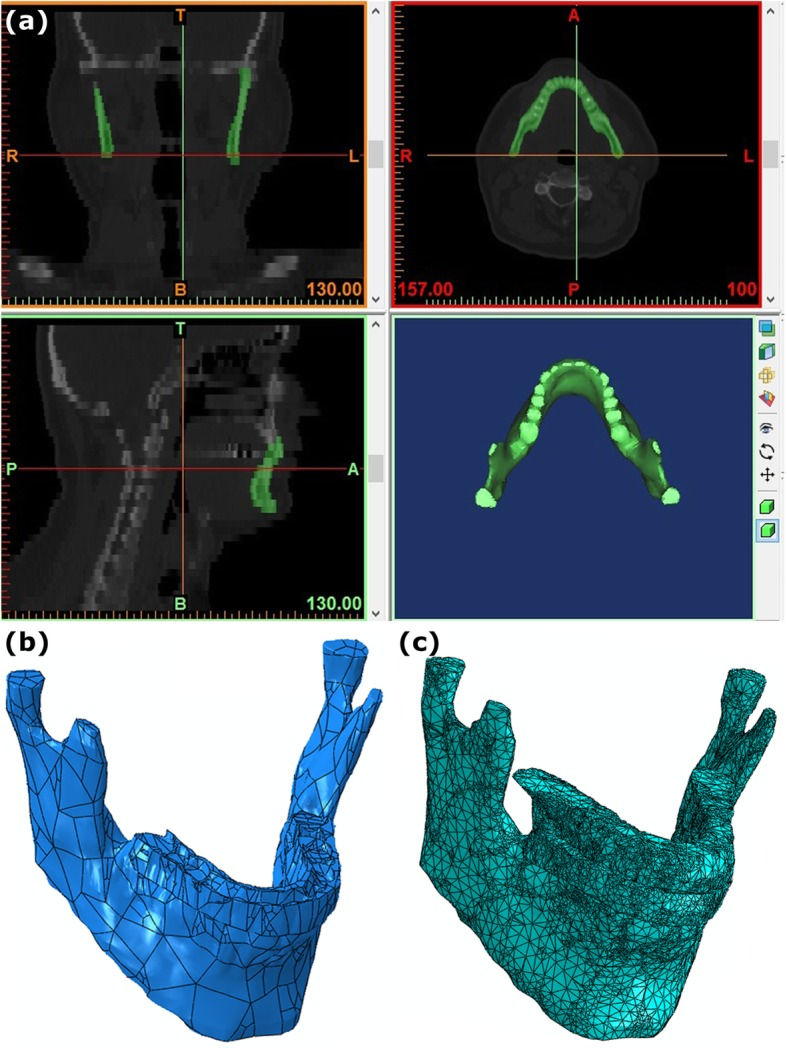 Figure 1: a. The point clouds of the maxilla, mandible and teeth. b 3D model. c Meshed model