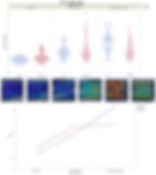 Figure 4: SWE of the musculus masseter by relaxed jaw (p < 0.01), 50% bite force (p = 0.722), and maximal jaw opening (p < 0.01) with the following settings: region of interest (ROI) size: 2; ROI shape: radius; frame rate: 1; time smoothing: