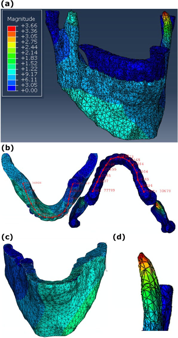 Figure 4: a Stress distribution of the jaw bone in a control subject b the manner of changes in deformation values in the upper and lower jaws. c Deformation distribution of the jaw bone in a control subject. d The location of maximum stres