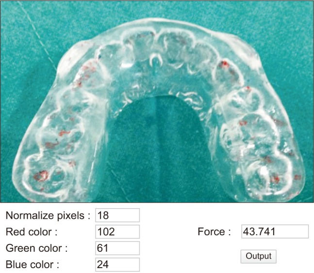 Clinical Decision Support Model to Predict Occlusal Force in Bruxism
