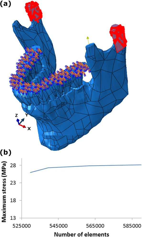 Figure 2: a Degree of freedom, interactions and constraints between the parts. b Diagram of the maximum stress in the head of mandible – the number of elements for grid independence study