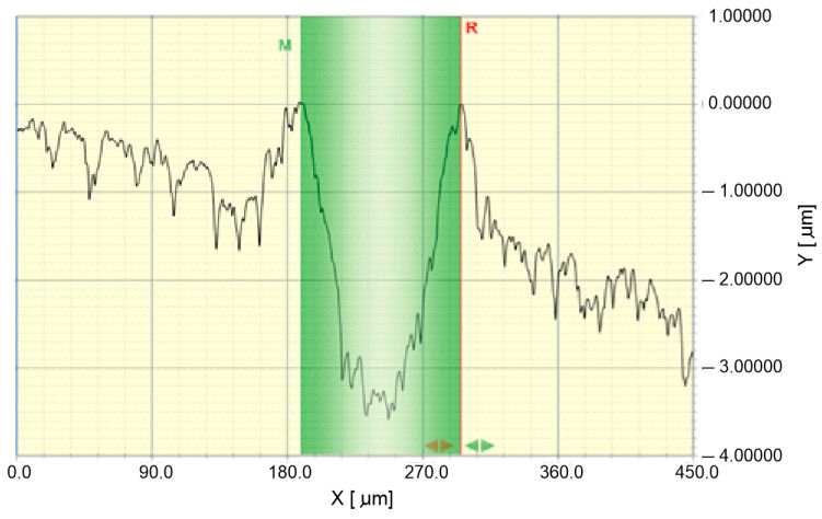 Figure 5: Measurement of the gap width (SWprofil) as the distance between the highest points of plastic pile-up (width of the green field) and the cross-sectional area of the gap, Sar