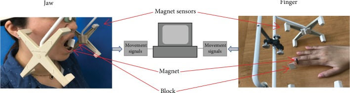 Figure 1 - Illustration of the movement recording equipment applied to the jaw and finger. Magnet attached to lower incisors in the midline or to the nail of the right index finger. Magnet sensors (4 × 2) in the headset recorded the vertical dimension of ...