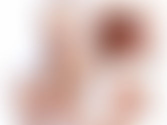 מחלת הפה והטלפיים HFMD