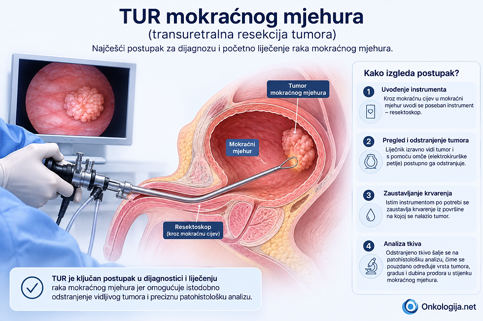 TUR mokraćnog mjehura