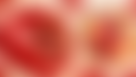 Ilustracija vezanja glukoze na hemoglobin unutar crvene krvne stanice – HbA1c