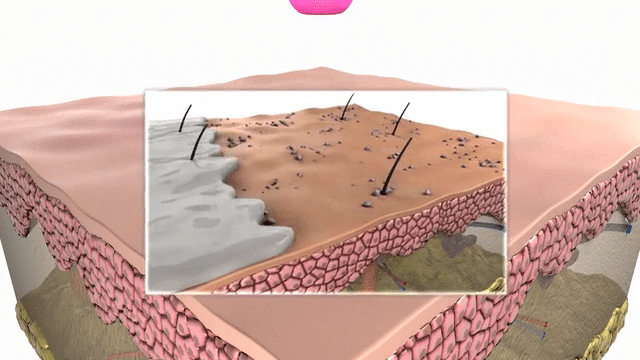 epidermis nourishment-low