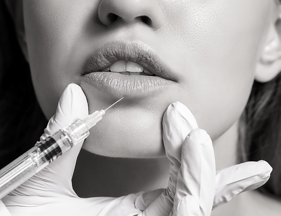 How Long Does Lip Filler Last? (And How to Make It Last Longer)