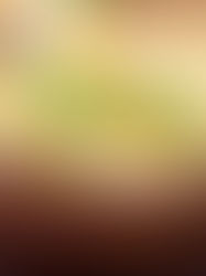 Consumo em excesso de ovos na dieta é saudável? Confira o que dizem especialistas