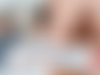 Hair loss hair growth - men vs women
