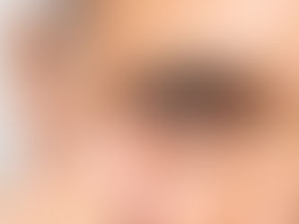 Bild på man med Gråstarr