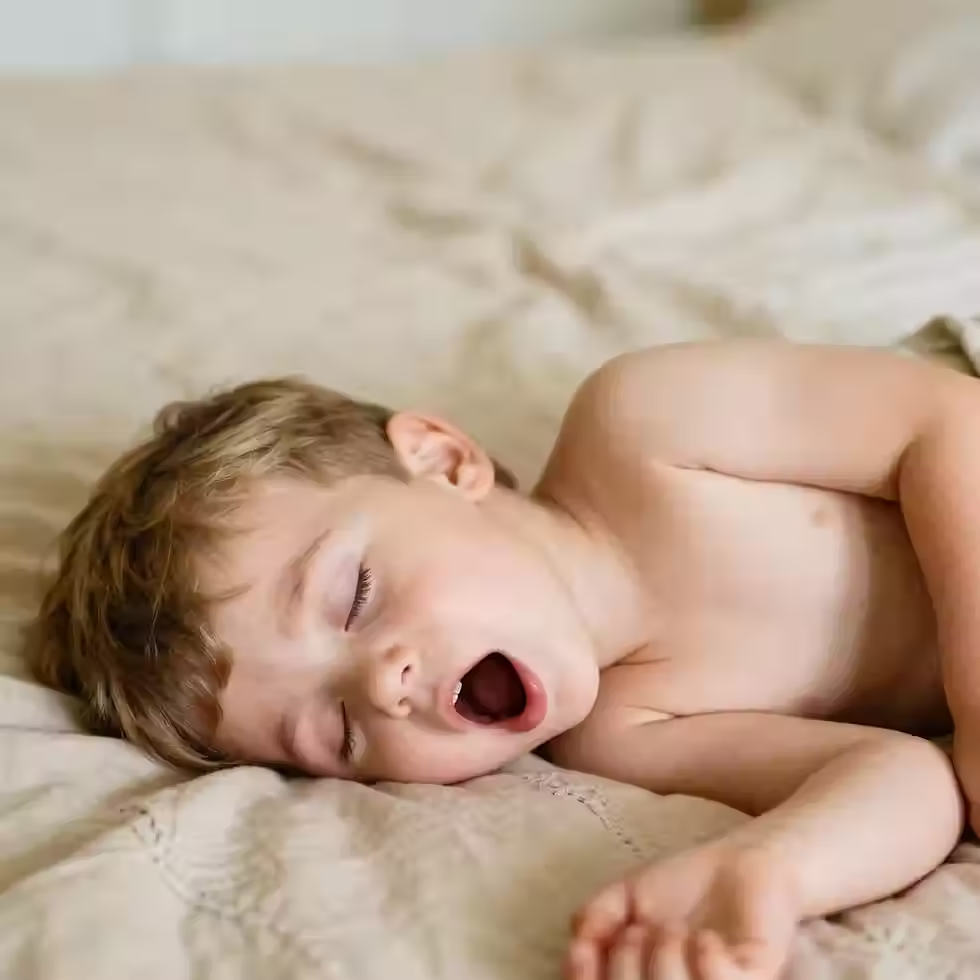 Crianca com apneia do sono dormindo de boca aberta