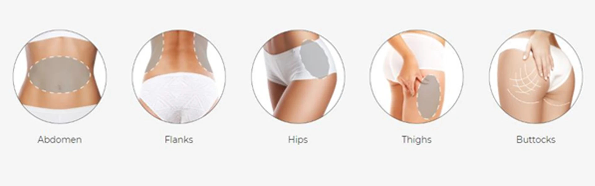 hifu-body-03-2.webp