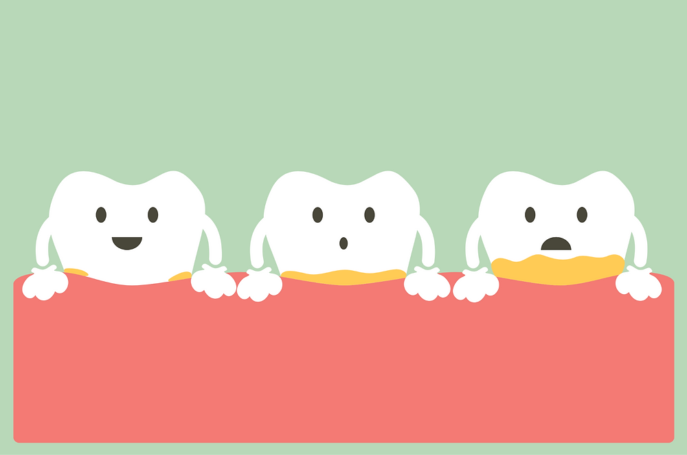 Can You Remove Plaque and Tartar at Home?