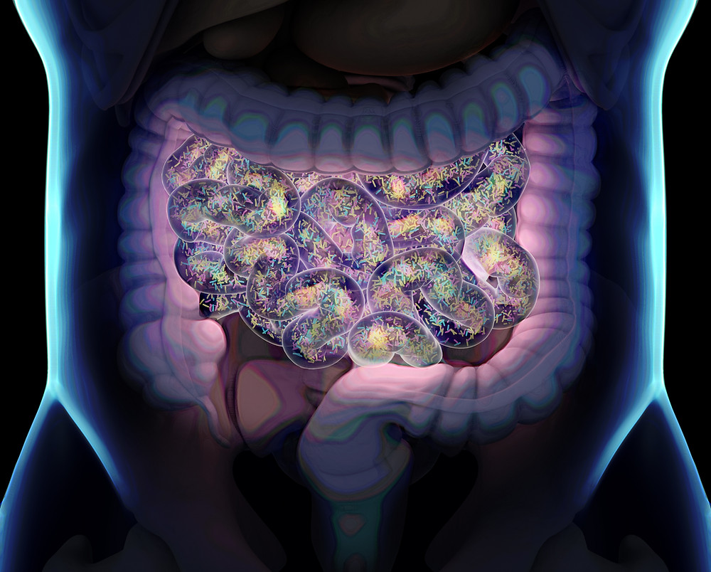 Are Your Uncomfortable Gut Symptoms Due to SIBO?