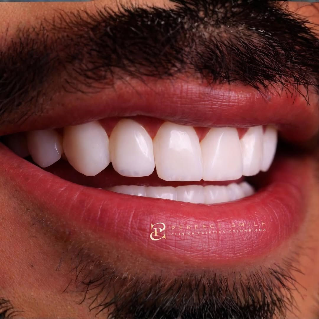 Diseño de sonrisa cdmx