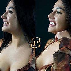 Diseño de sonrisa cdmx