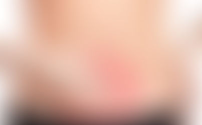 Você sabe o que é  Endometriose?