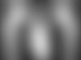 Hüftdysplasie: Wann PAO und wann Hüftprothese