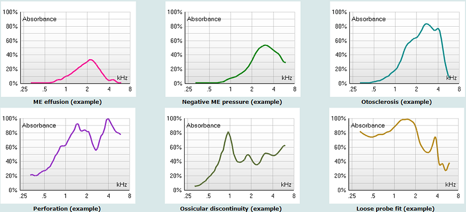 Normatifler.png