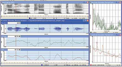 Analysis of Dysphonia in Speech and Voice