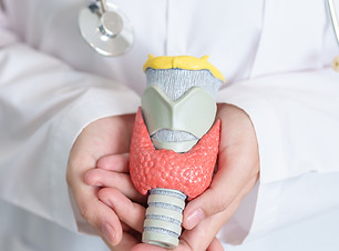 Doctor with human Thyroid anatomy model. Hyperthyroidism, Hypothyroidism, Hashimoto Thyroi