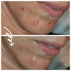 Cliniccare Pure Facial