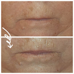 Cliniccare Cinderella Facial