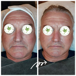 Microcurrent Booster Facial