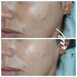 Cliniccare Glow Facial