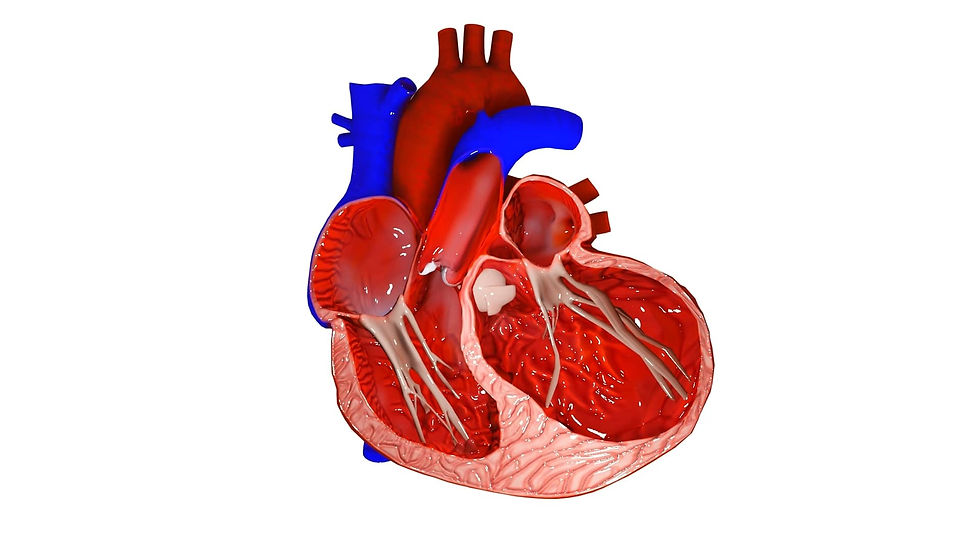 https://www.eduovisual.com/examquestion/dilated-cardiomyopathy