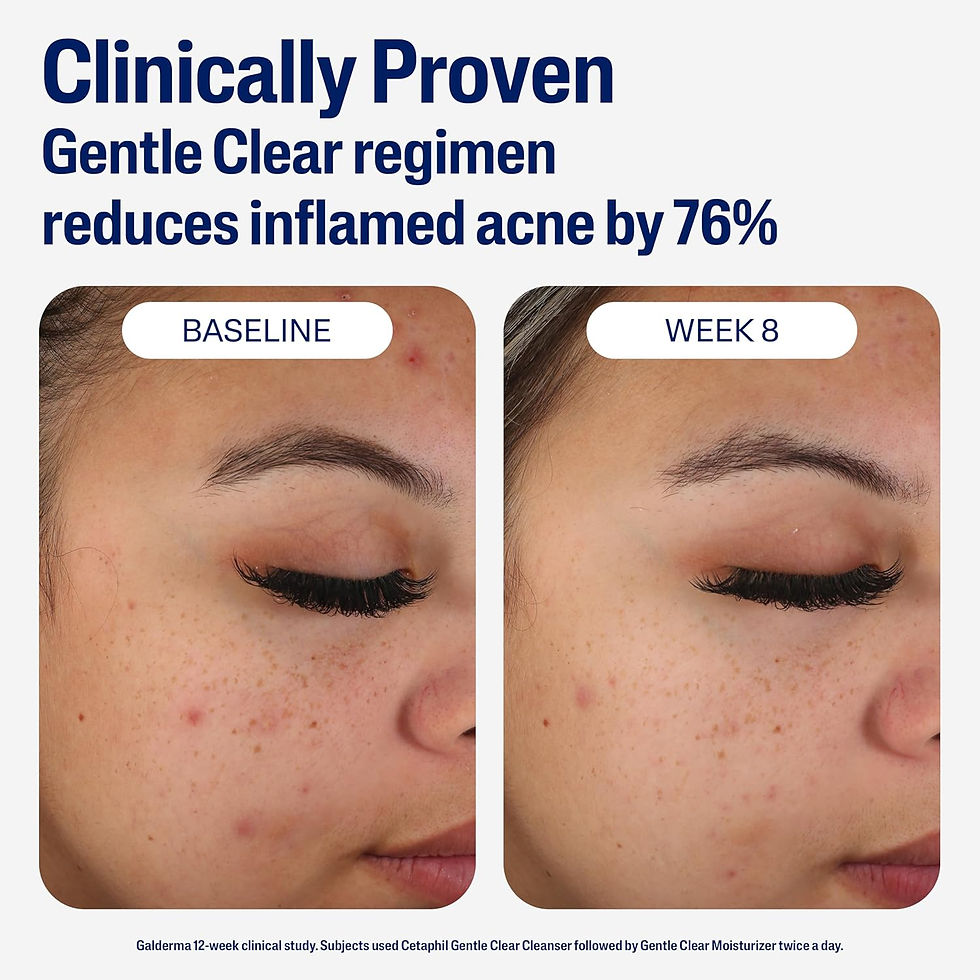Thumbnail: Cetaphil Gentle Clear Mattifying Acne Moisturizer,3oz #1096