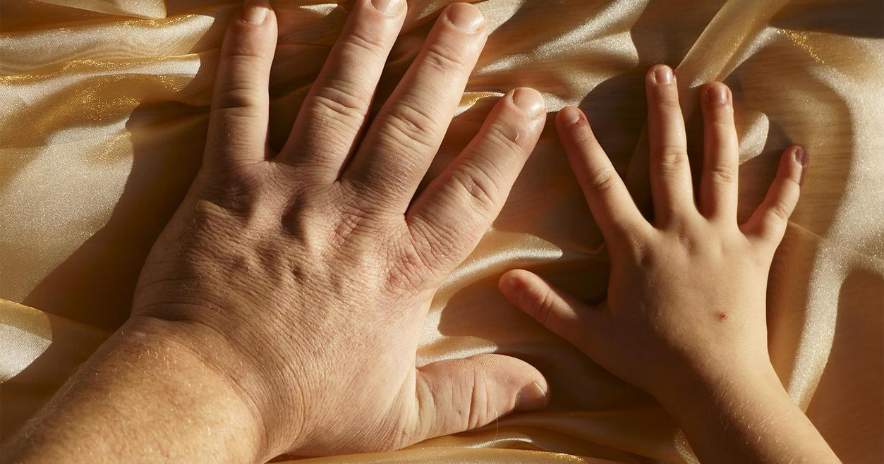 Acromegaly_PE_1796x943.jpg
