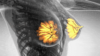 GLA.gif