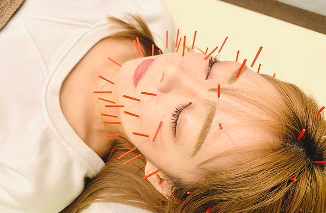 入江鍼灸整体院（治療・美容鍼）首の痛み・腰痛・肩こり・あらゆる症状