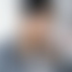 스트레스 완화를 위한 두피 마사지의 놀라운 이점