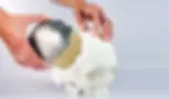 D Printed Medical Implants Market is projected