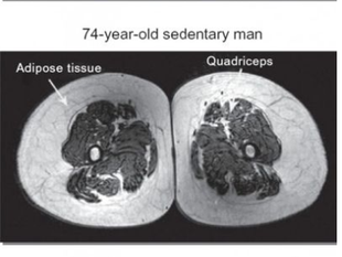 Stronger Thighs, Happier Knees