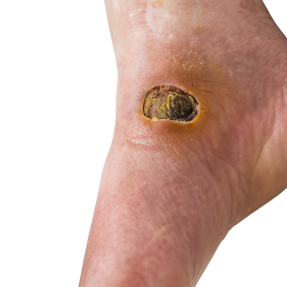 Imagem ilustrativa de infecção de pele com vermelhidão e inflamação local.