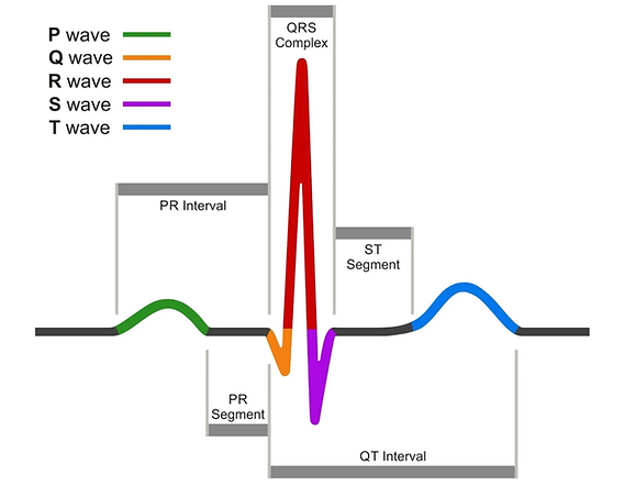 How Smart Wearables Work: ECG, PPG, HRV & Sensor Technology Explained: ECG waveform labelled