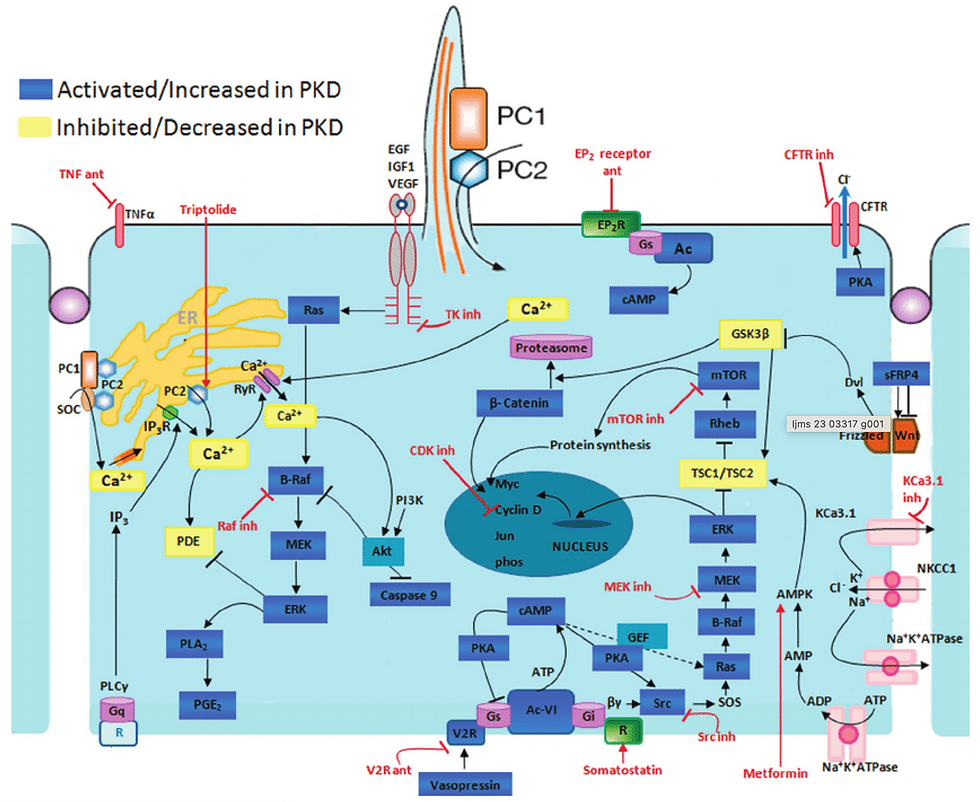 Patholphysiology of ADPKD