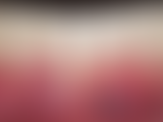 caso de tratamiento de retraccion de encias en malaga con periodoncista