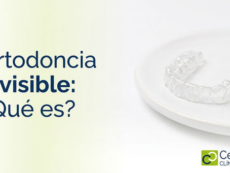 Ortodoncia invisible: qué es, cómo funciona y para quién es adecuada