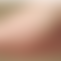 Bị Nổi Mề Đay Nên Xông Lá Gì? Top Lá Xông Tự Nhiên Hiệu Quả