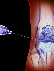 infiltrazione articolare, medicina rigenerativa, acido ialuronico, PrP, cellule staminali