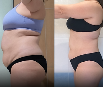 Tania before and after.png