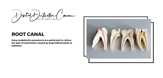 Root Canal Treatment Cancun Dental Destinations Cancun Get the facts from webmd on this common procedure. root canal treatment cancun dental