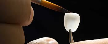 Cosmetic Veneers in cancun